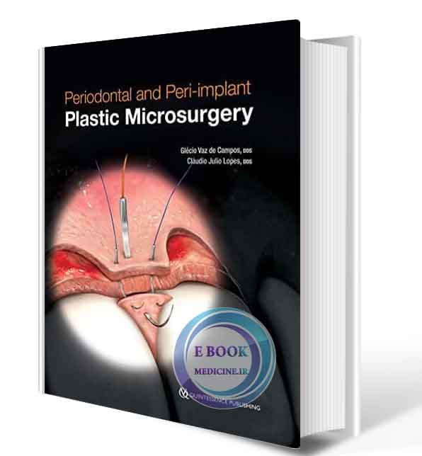 دانلود کتاب Periodontal and Peri-implant Plastic Microsurgery: Minimally Invasive Techniques with Maximum Precision  2021 (ORIGINAL PDF)